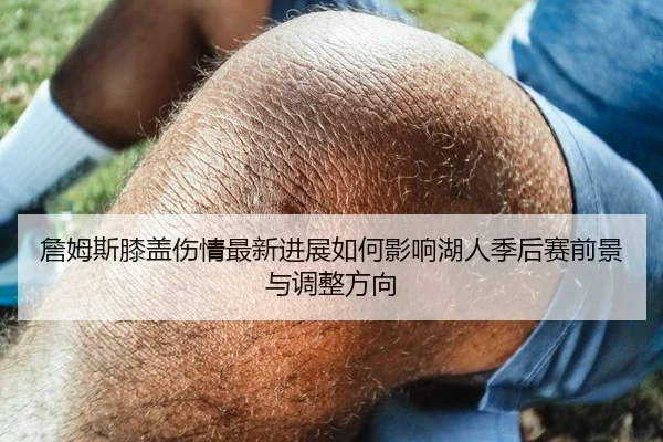 詹姆斯膝盖伤情最新进展如何影响湖人季后赛前景与调整方向
